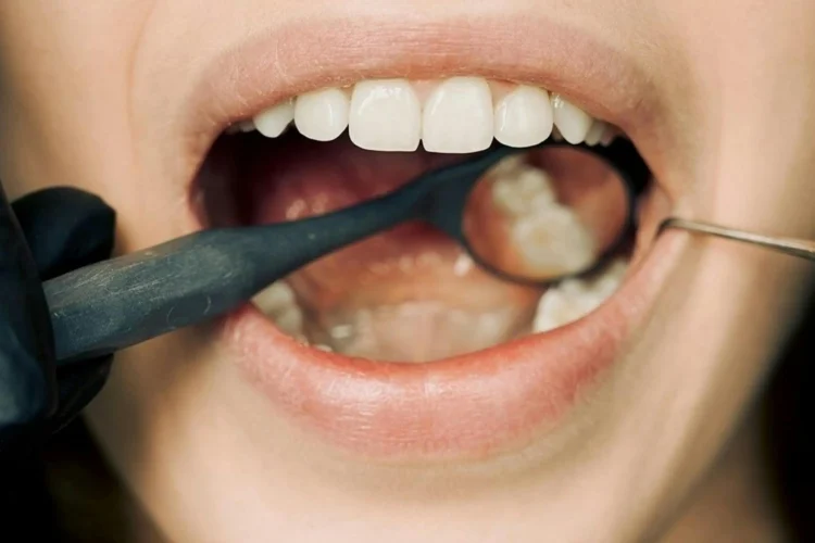 Dentist examining a patient's dental crown