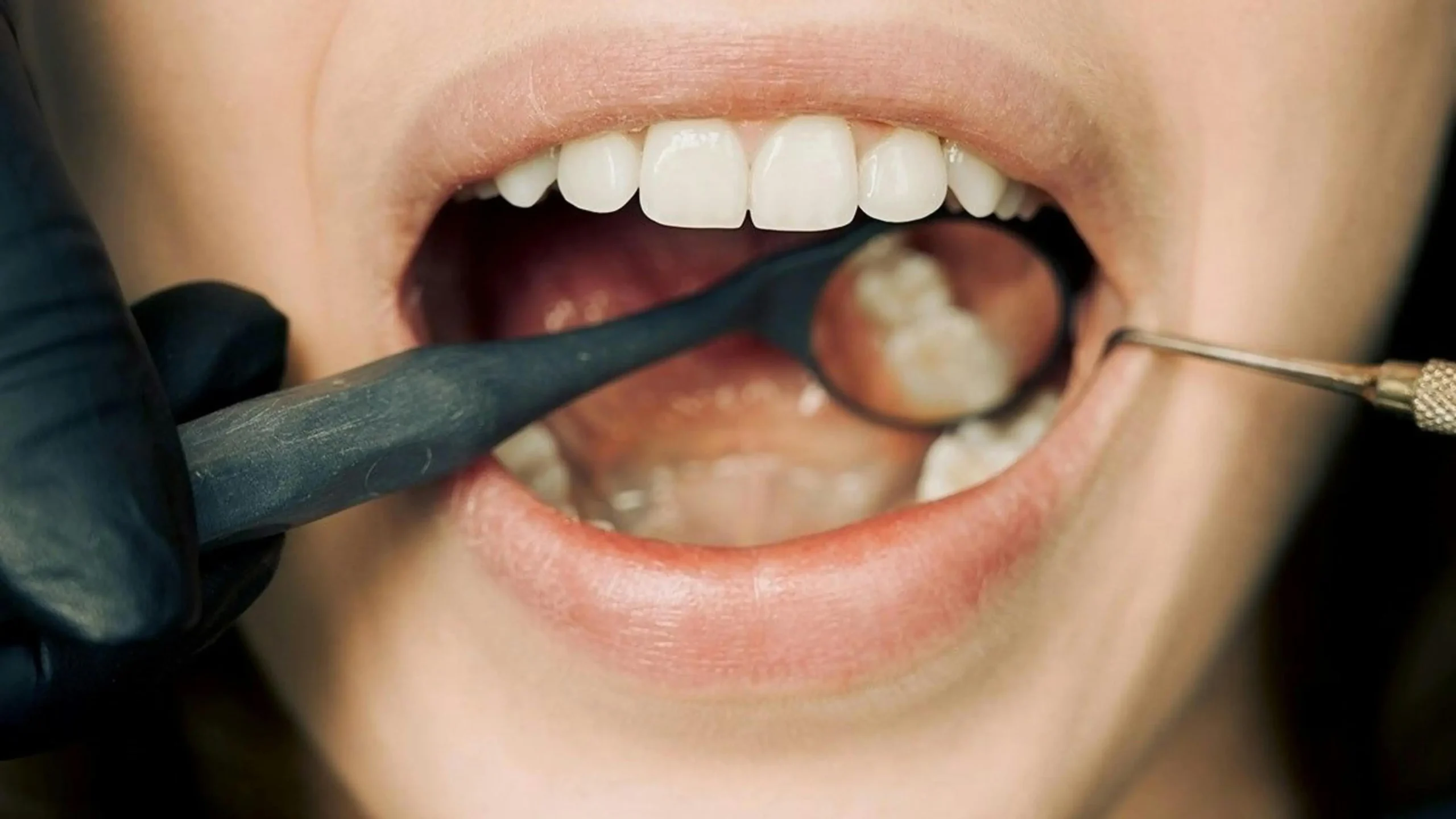 Dentist examining a patient's dental crown