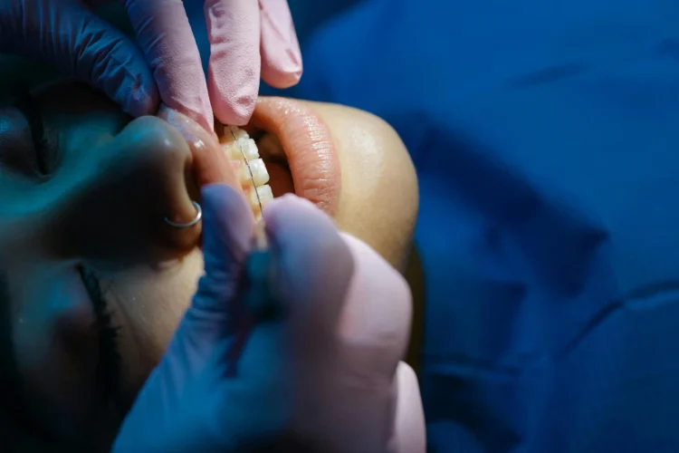 Dentist examining patient's teeth for dental crown procedure