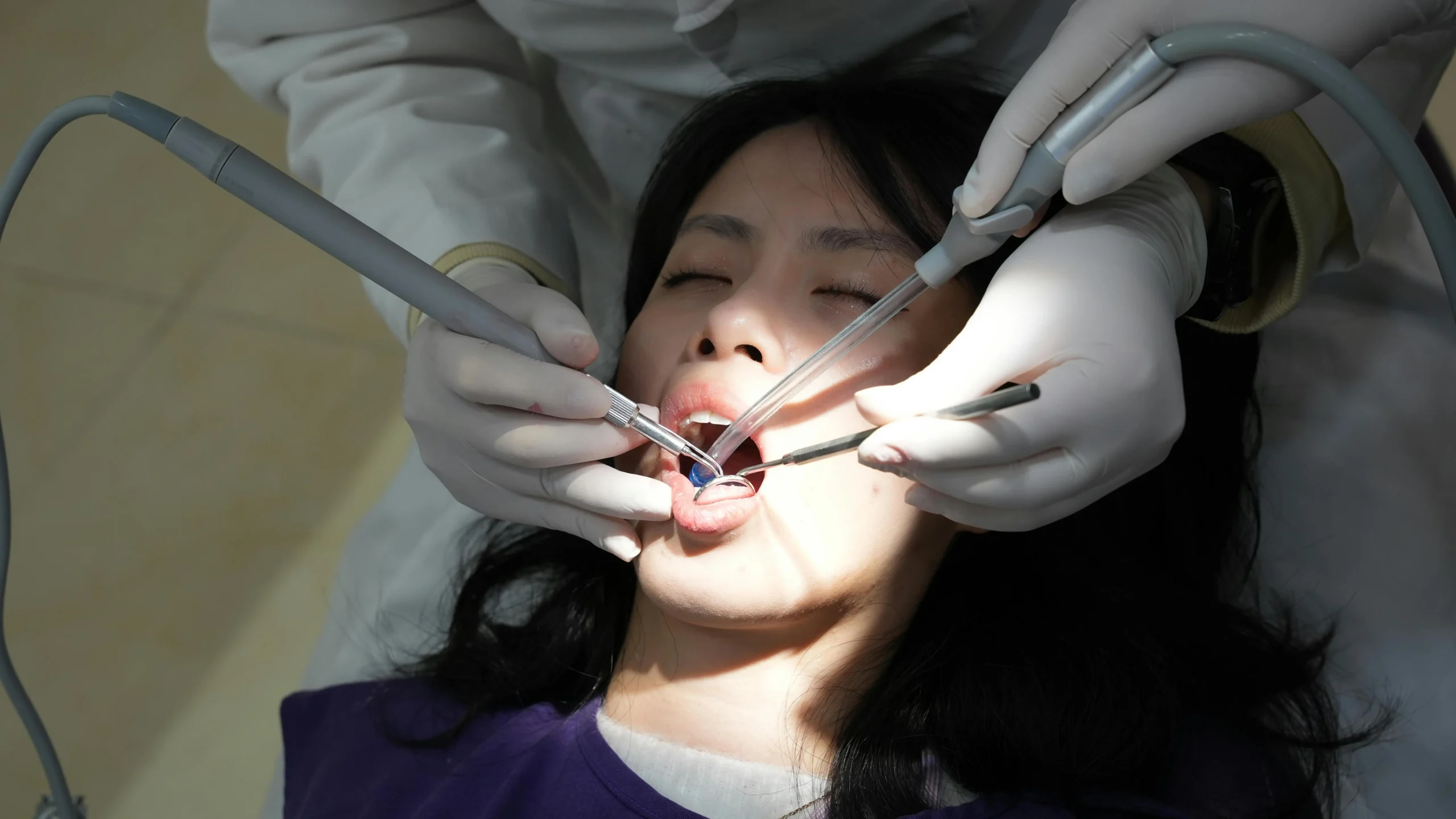 Woman having teeth cleaned by dentist to start her Invisalign treatment