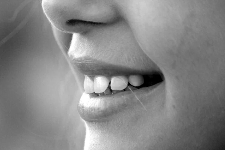 Close-up of teeth showing veneers after braces