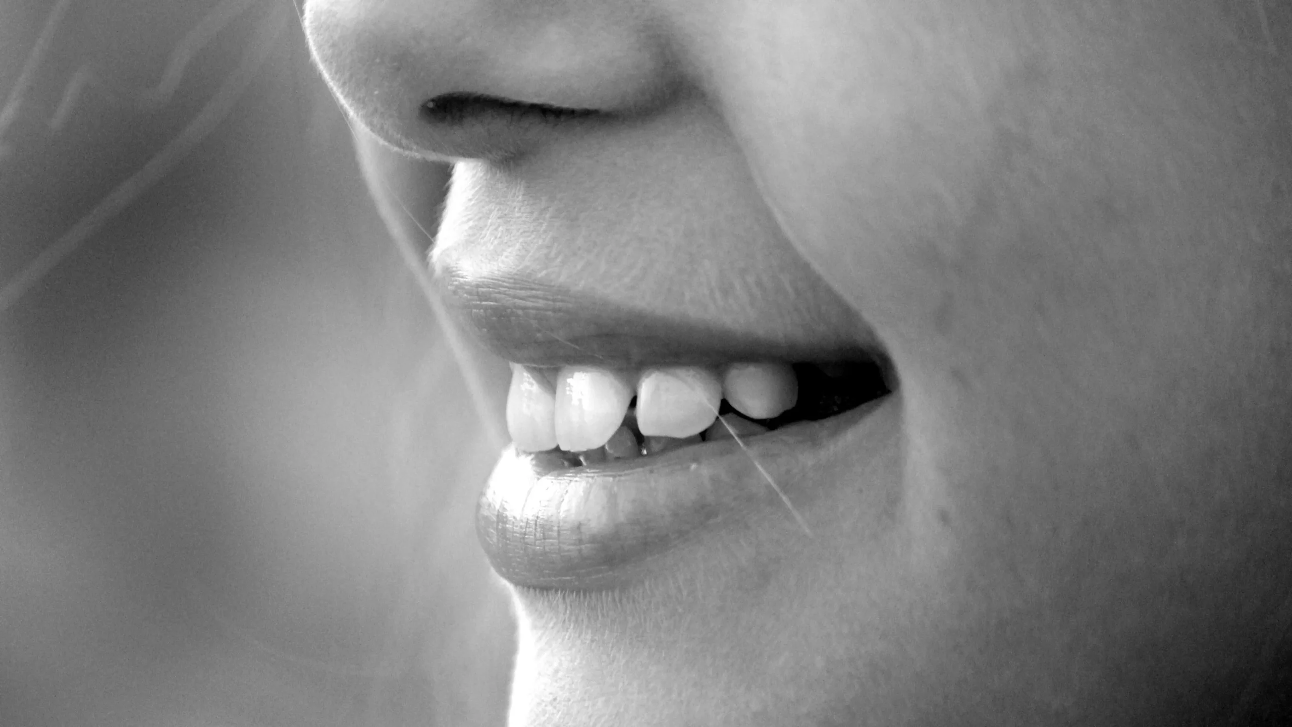 Close-up of teeth showing veneers after braces