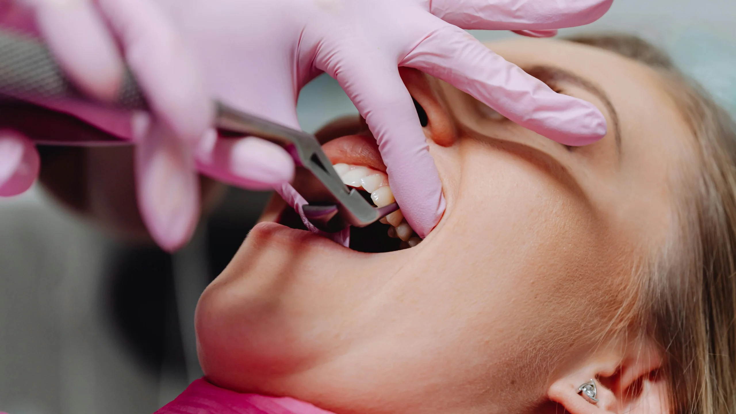 Dentist with pink gloves providing pain-free dental experience to a woman