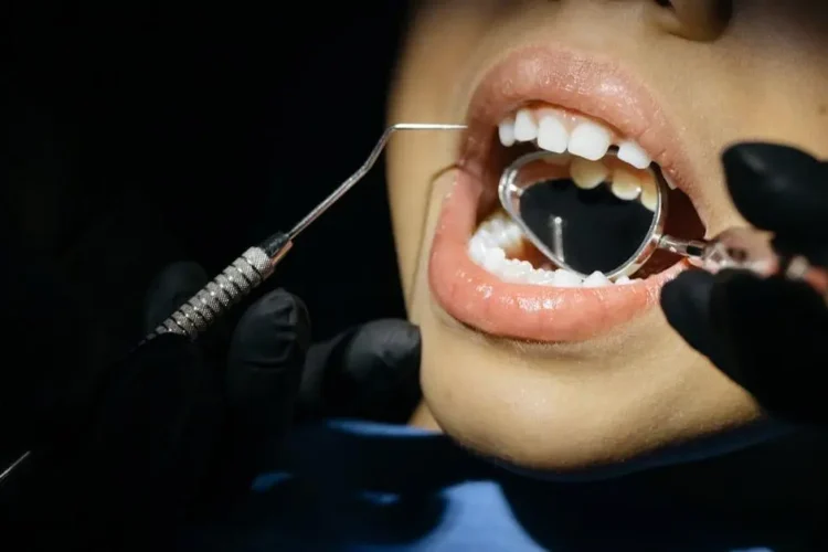 Child receiving dental checkup, highlighting when a child should start seeing a dentist.