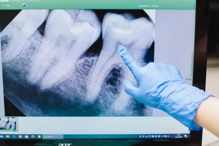 Pointing at tooth on screen, illustrating common dental myths