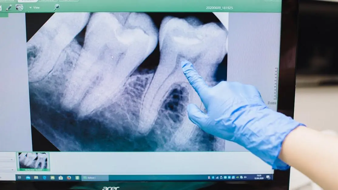 Pointing at tooth on screen, illustrating common dental myths