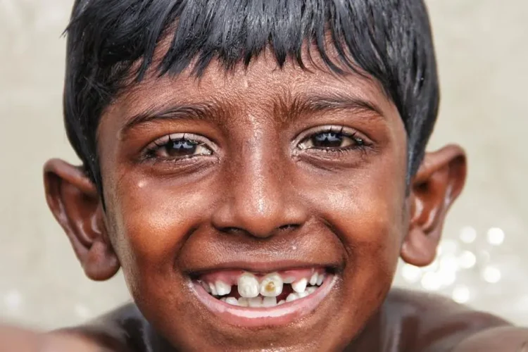 Boy smiling with visible deciduous teeth.