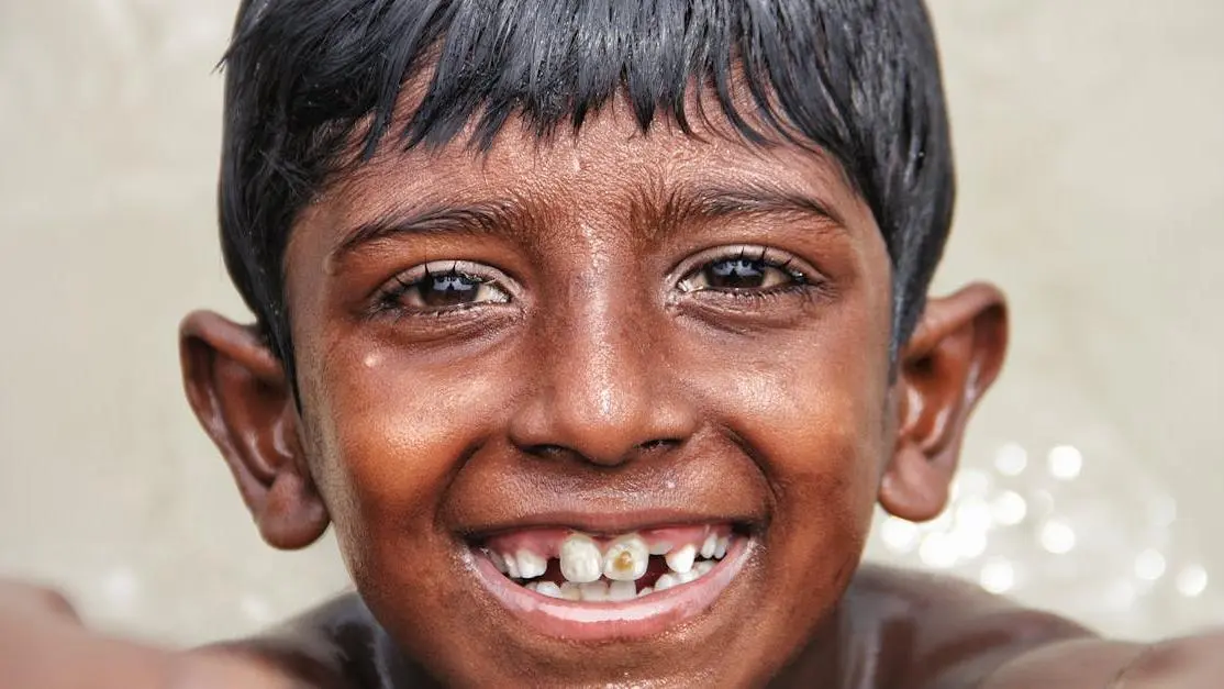 Boy smiling with visible deciduous teeth.