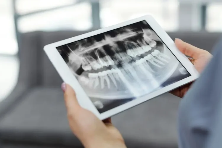 Tablet displaying digital dental impressions and dental X-ray.