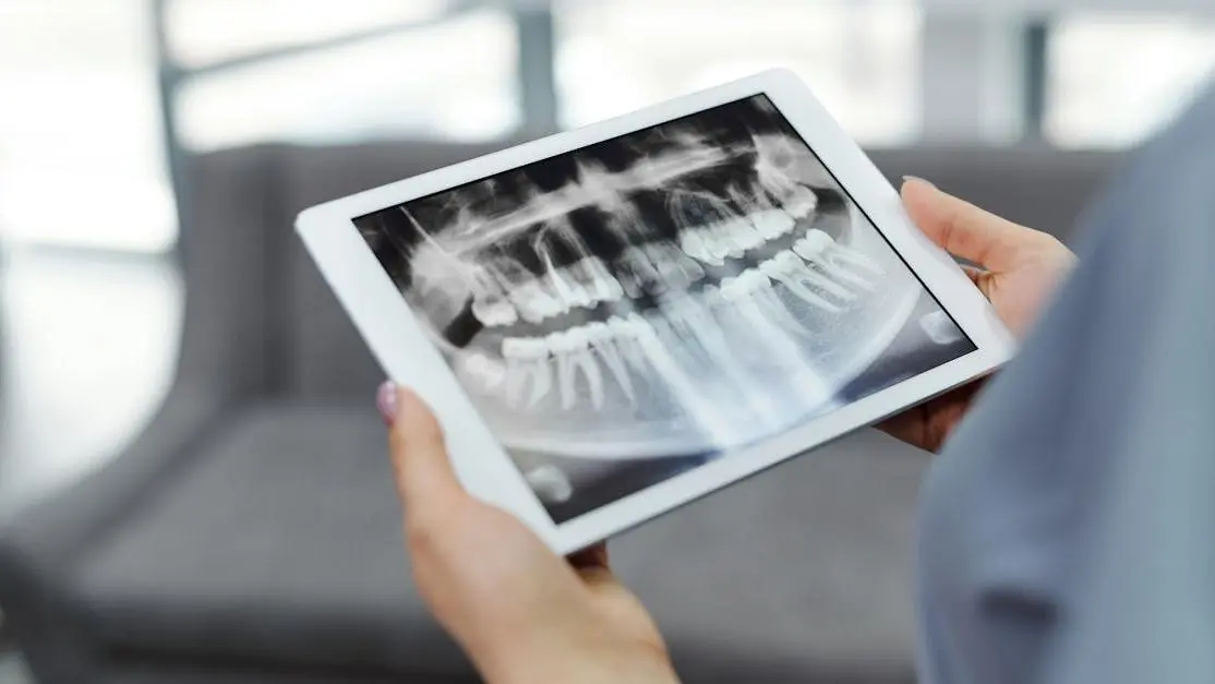 Tablet displaying digital dental impressions and dental X-ray.