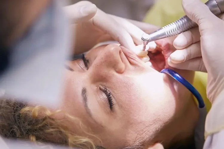 Dentist cleaning woman's teeth to prevent dry socket