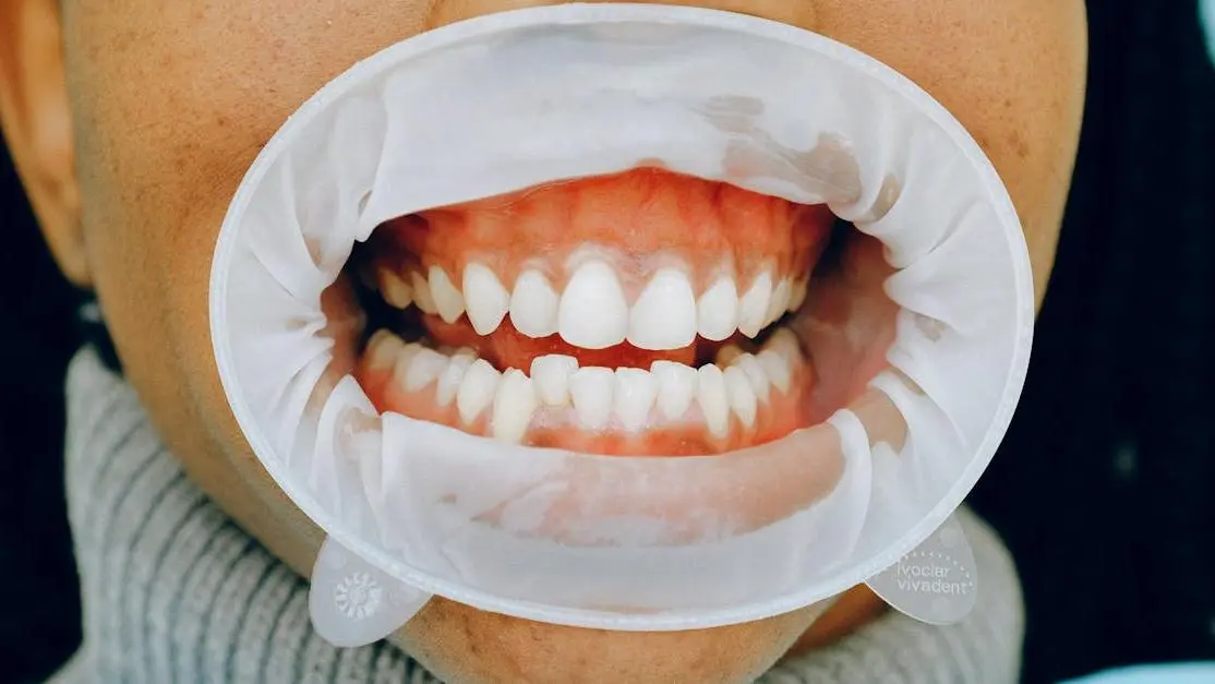 Dental examination showing effects of smoking on oral health.