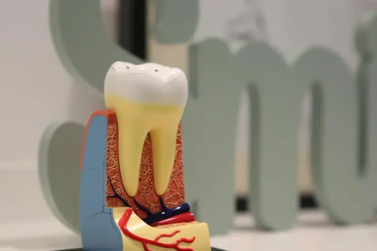 Model showing genetics in tooth disorders.