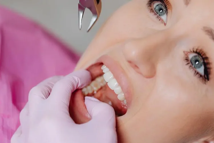 Patient during tooth extraction procedure for removal of teeth