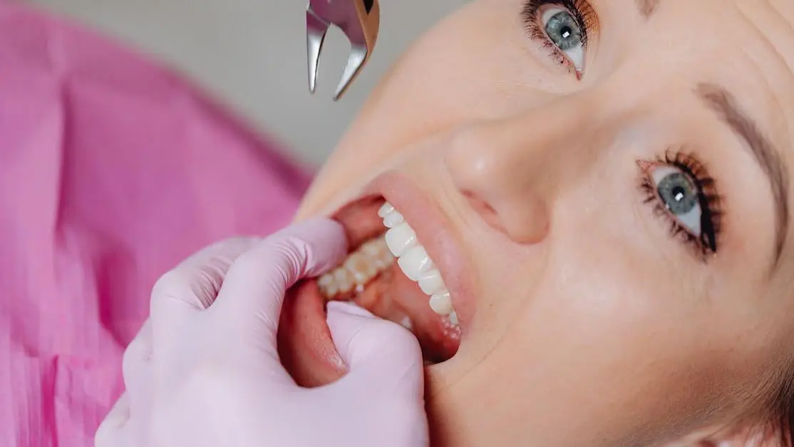 Patient during tooth extraction procedure for removal of teeth