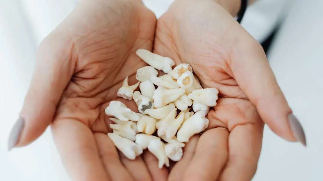 Person Holding Teeth, Highlighting Tooth Decay