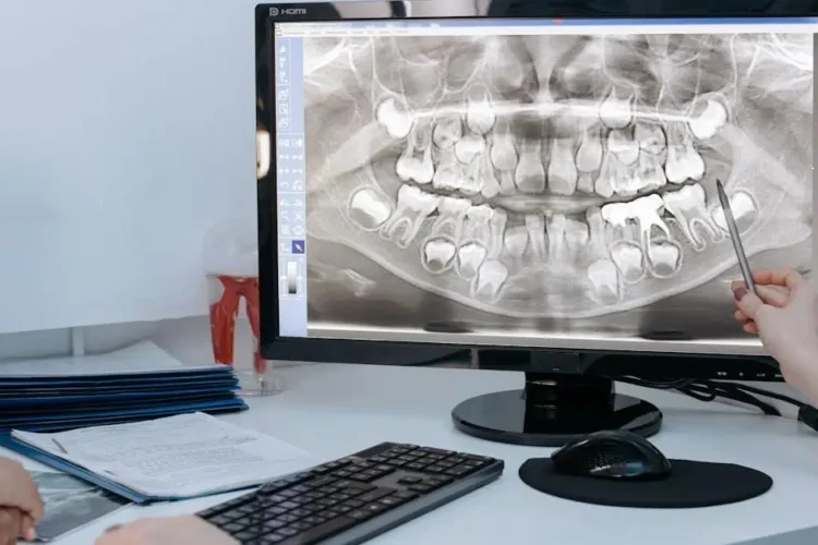 X-ray showing ankylosed tooth on computer screen