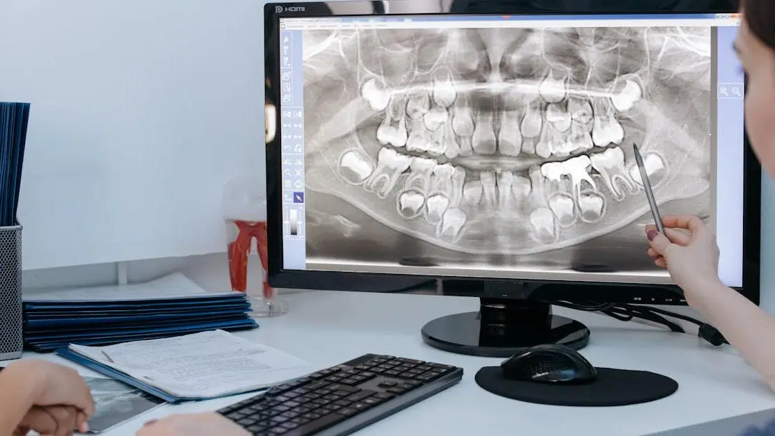 X-ray showing ankylosed tooth on computer screen