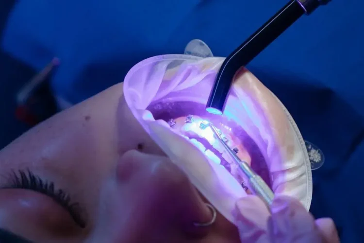 Patient receiving dental treatment with clear braces