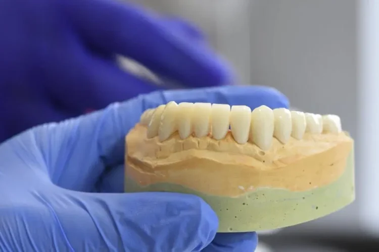 Dental model held by gloved hands showcasing Cost of dental implants.