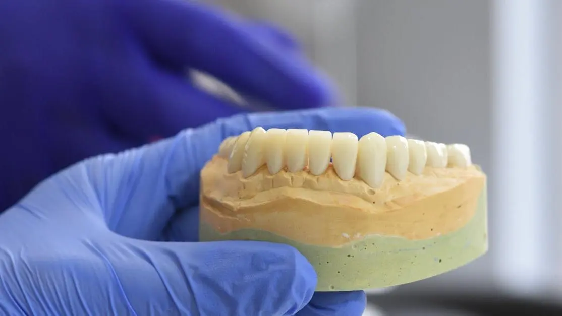 Dental model held by gloved hands showcasing Cost of dental implants.