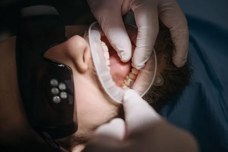 Patient showing gum disease symptoms with open mouth.