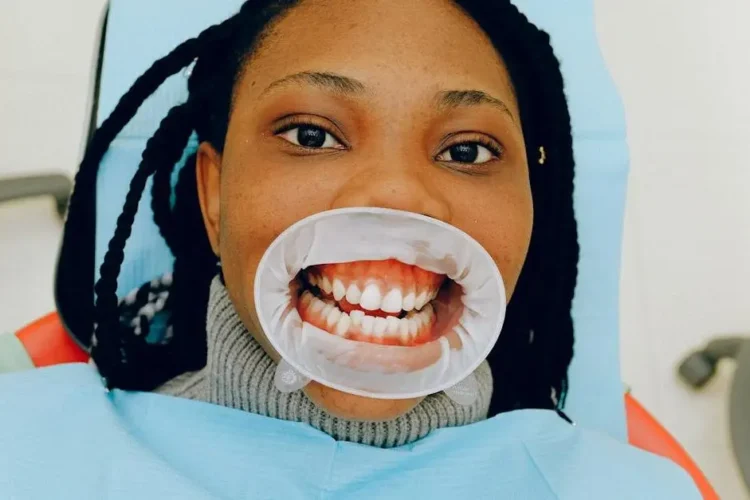 Dental exam showing woman's open bite with cheek retractor.