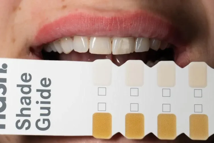 Dental shade guide comparison for professional vs. at-home teeth whitening outcomes.