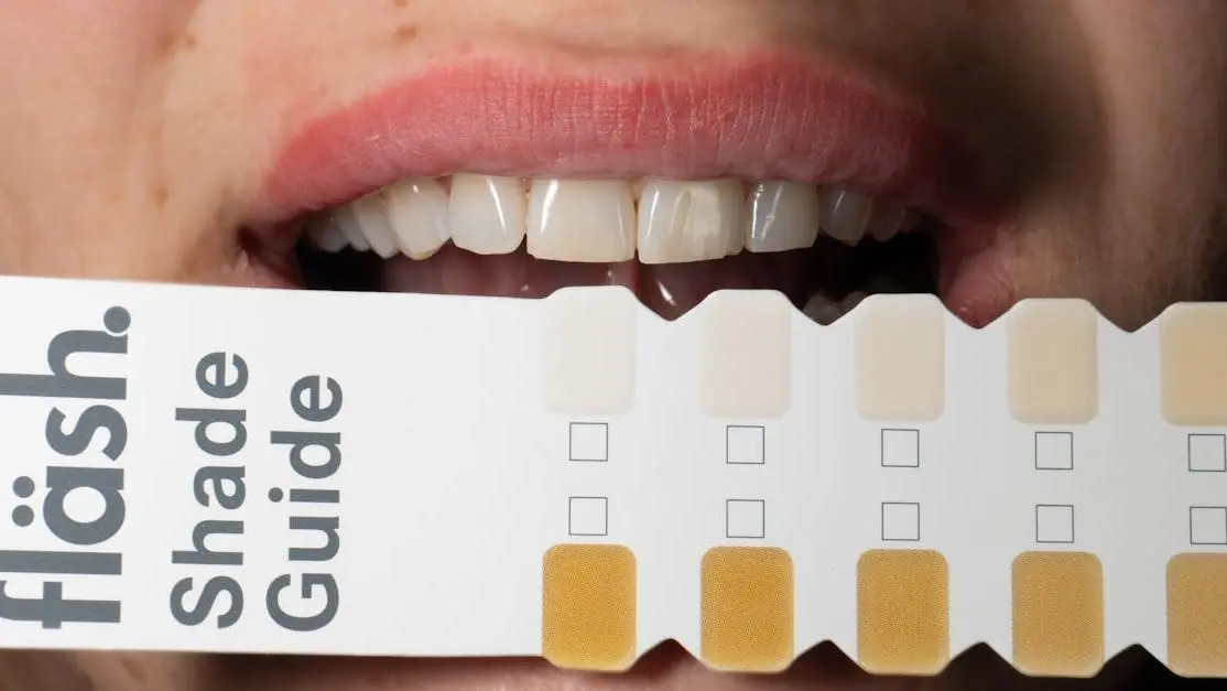 Dental shade guide comparison for professional vs. at-home teeth whitening outcomes.