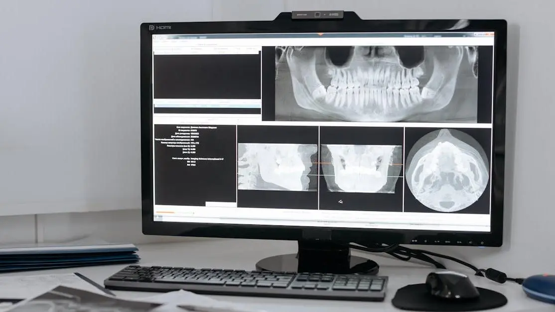 Dental X-ray indicating when to seek emergency dental care.